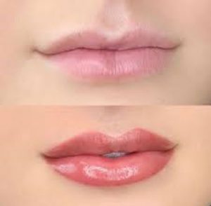 cosmetic-lip-blush